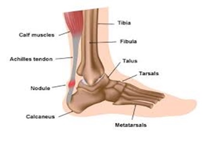 ankle achilles pain