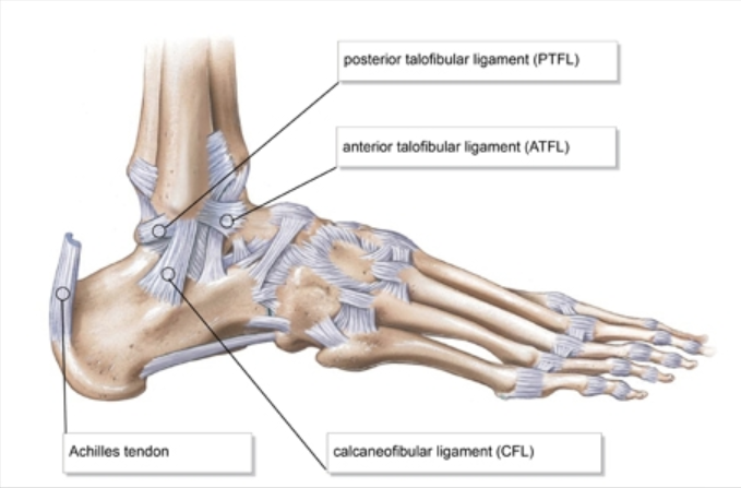 Ankle Injuries: When an Ankle Sprain is Not a True Ankle Sprain