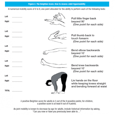 Patellar Instability - Vasta Performance Training and Physical Therapy