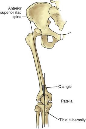 Patellar Instability - Vasta Performance Training and Physical Therapy