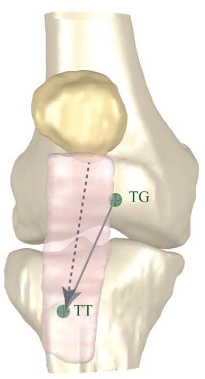 Patellar Instability - Vasta Performance Training and Physical Therapy